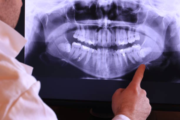 Best Emergency Dental Extractions in Stewartville, AL