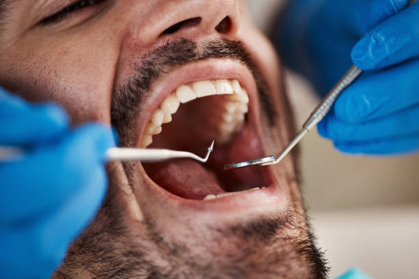 Best Emergency Dental Services for Seniors in Stewartville, AL