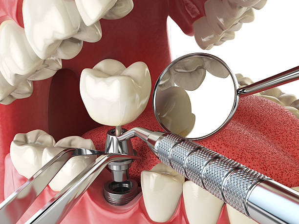 Best Orthodontic Emergency Dentist in Stewartville, AL